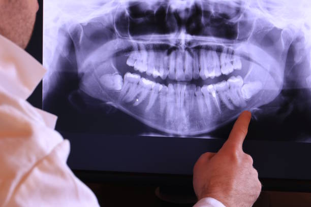 Best Broken or Cracked Tooth Emergency Dentist in Jackson, TN