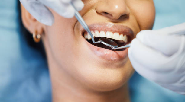 Best Emergency Dentist for Knocked-Out Tooth in Jackson, TN